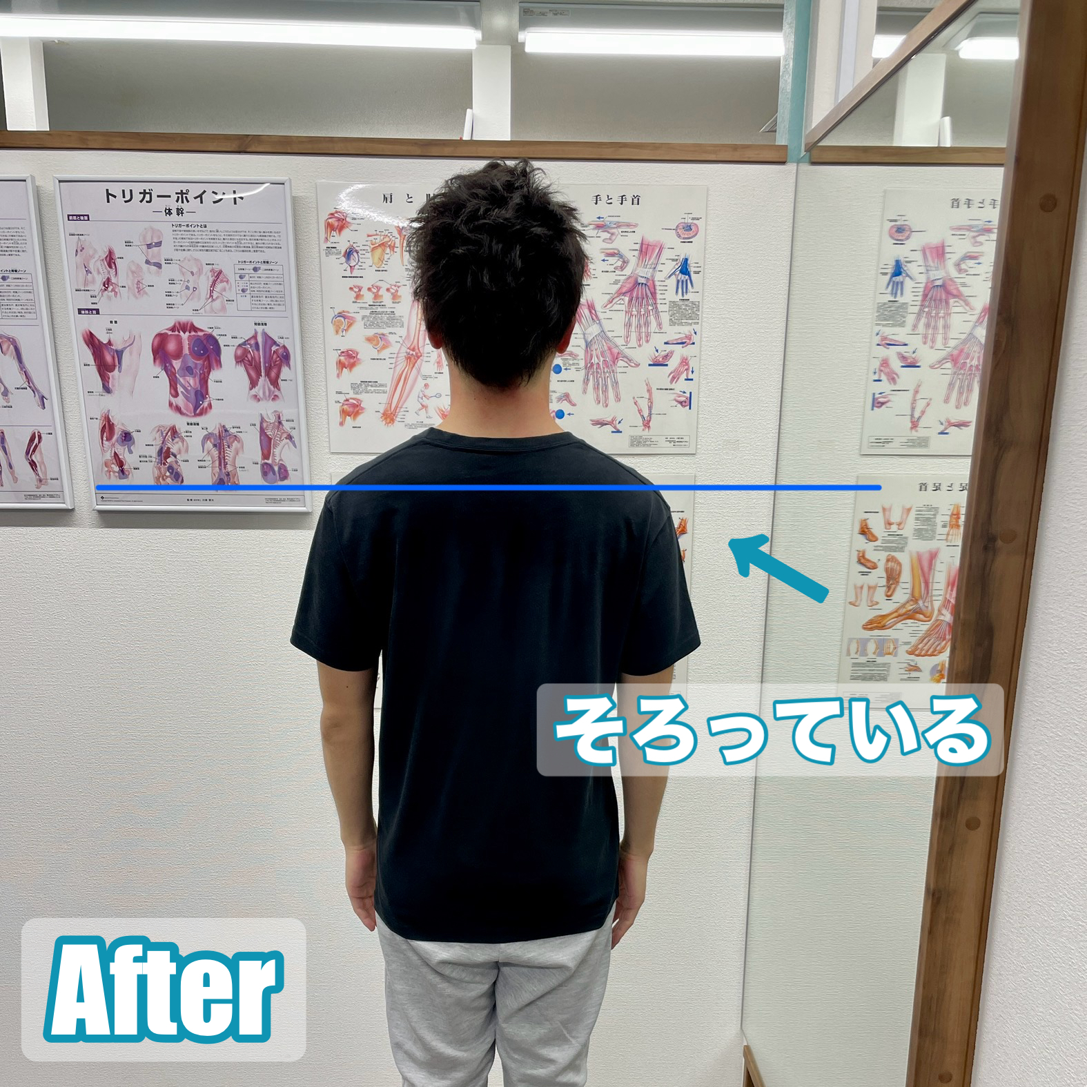 after