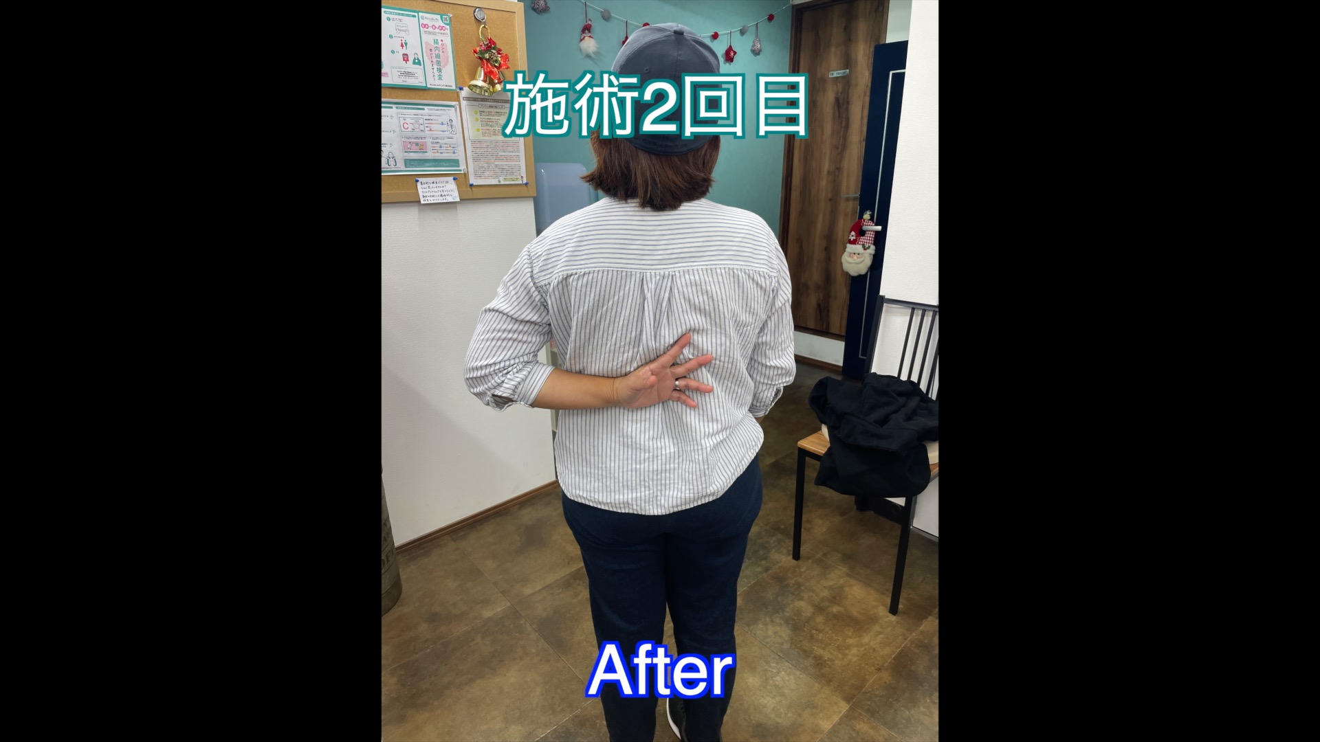 肩の痛み15A