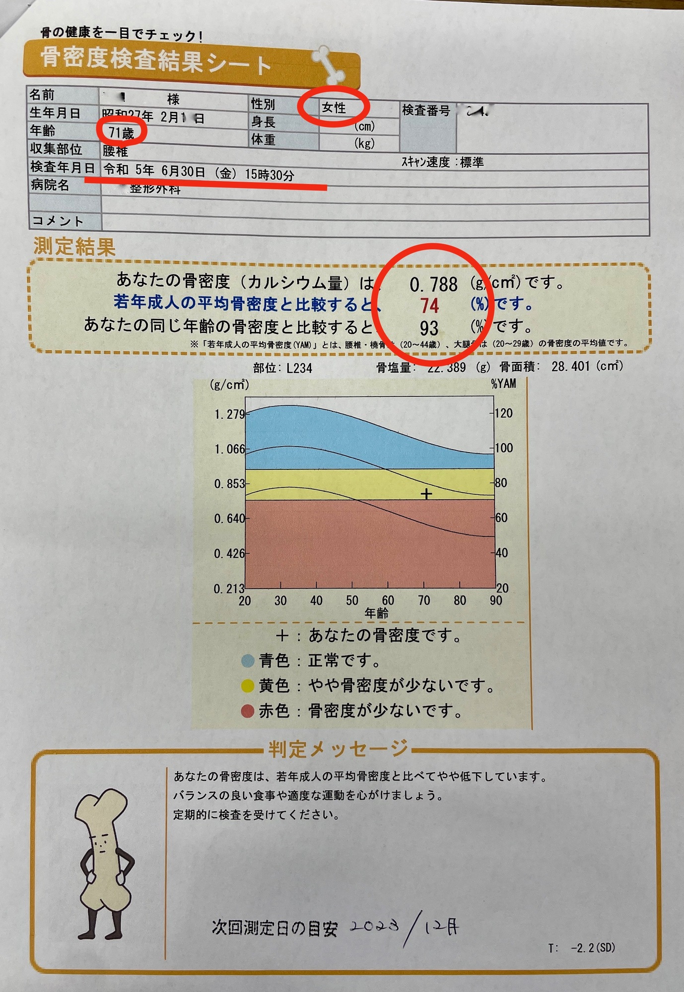 Before Before
